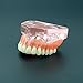 Dentalmall 1 Pc Dental Model #6001 01 - Overdenture Superior with 4 Implants Demo Model