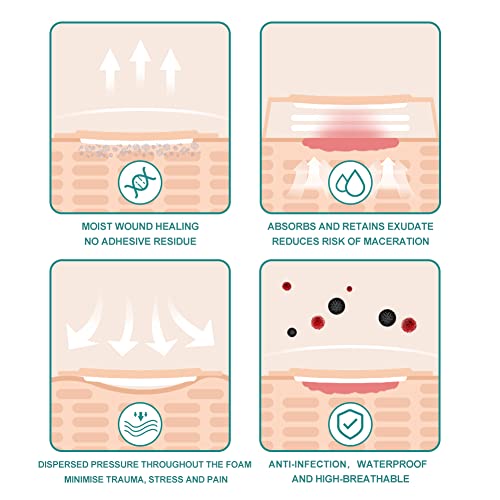 Silicone Foam Dressing, 6'' x 6''(4.3" X 4.3" pad) Sacrum Wounds
