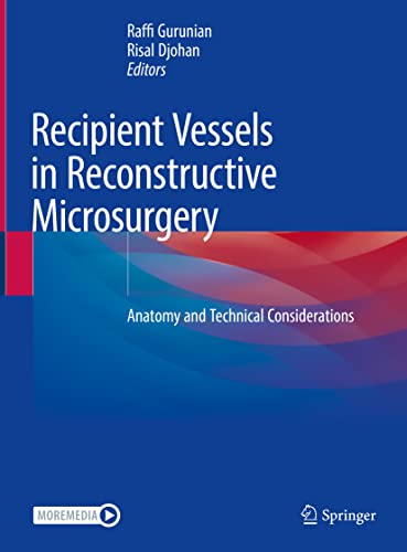 Recipient Vessels in Reconstructive