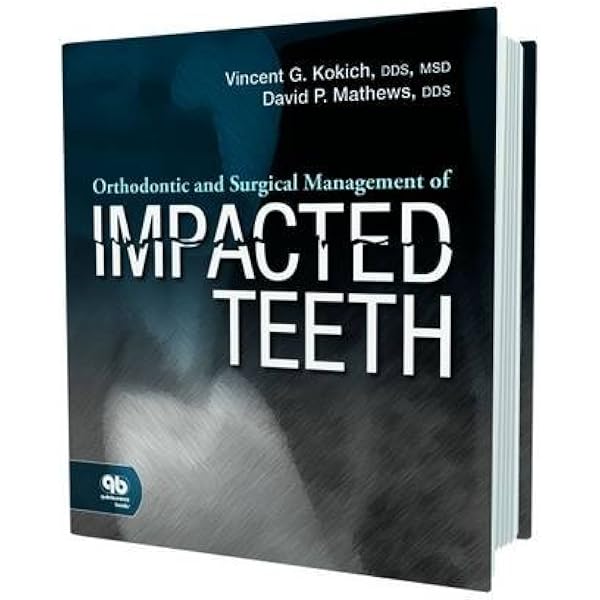 健康・医学 Implant Dentistry: Theory and Practice 健康・医学 Implant Dentistry: Theory and Practice IMPLANT