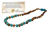Baltic Amber Teething Necklace for Babies (Unisex) (Honey Multi Cherry Black Red Milk White Butter Yellow Cognac Brown Rainbow Turquoise Pink Quartz Lapis Lazuli Lemon) - Baby, Infant, and Toddlers will all benefit. Polished Anti Flammatory, Drooling & Teething Pain Reduce Properties - Natural Certificated Oval Baroque Round Baltic Jewelry with the Highest Quality Guaranteed. Easy to Fastens with a Twist-in Screw Clasp Mothers Approved Remedies! (Cognac Turquoise)