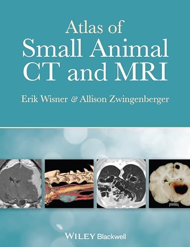 Color Atlas of Microneurosurgery: 9783131111029: Medicine & Health