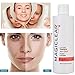 Luxury Dark Spot Remover for Face Toner Anti Spots Lotion - Melasma Tonic - Best Swiss Brand Magiclear 200 ml…