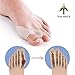 Bunion Corrector - Set of 2 Soft Silicone Gel Bunion Toe Straighteners, Big Toe Separator, Toes Spreaders, for Bunion Pain Relief Crooked Toes, Pressure, and Hallux Bunions