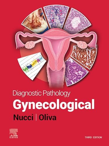 Amazon.com: Diagnostic Histopathology of Tumors E-Book: Expert