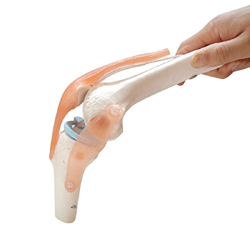 Tinsay Knee-joint Medical Model Anatomical Anatomy Functional,Size:17x14.5x29.5CM