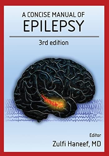 Amazon.com: Epilepsy: A Comprehensive Textbook (3-volume set