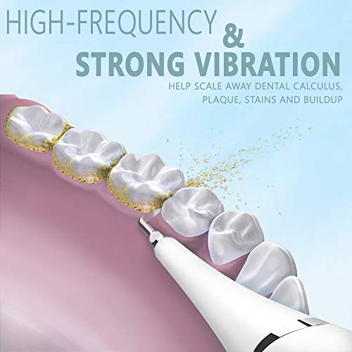Tartar, Plaque Remover For Teeth Cleaning Kit - Ultrasonic Tooth Cleaner - Dental Calculus Remover - Removes Calculus, Stain, Plaque, Tartar - Teeth Cleaning Tool #1 (White)