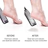 FOLAI-Foot-File-Foot-Pedicure-Tool-Stainless-Steel-Foot-File-Dead-Skin-Remover-Foot-Care-Pedicure-Tool-for-Cracked-Feet-Make-Foot-Beauty-and-Extra-SmoothBlack FOLAI Foot File Foot Pedicure Tool, Stainless Steel Foot File, Dead Skin Remover Foot Care Pedicure Tool for Cracked…