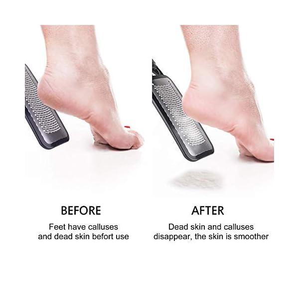 FOLAI-Foot-File-Foot-Pedicure-Tool-Stainless-Steel-Foot-File-Dead-Skin-Remover-Foot-Care-Pedicure-Tool-for-Cracked-Feet-Make-Foot-Beauty-and-Extra-SmoothBlack FOLAI Foot File Foot Pedicure Tool, Stainless Steel Foot File, Dead Skin Remover Foot Care Pedicure Tool for Cracked…