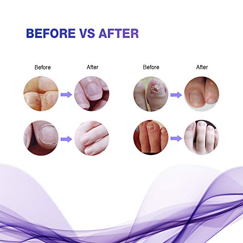 5 GoPro+GHDS30+Head+Strap+Mount