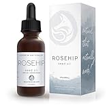 Foxbrim Organic Rosehip Seed Oil - Virgin Cold Pressed & Unrefined - Perfect for improving Hair, Skin, Nails & Fading Wrinkles, Stretch Marks & Scars - Rich in Omega Fatty Acids, Vitamins A & C - 2OZ