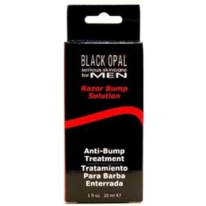 Amazon.com: Black Opal Mens Razor Bumps Solution 1oz (3 Pack): Beauty