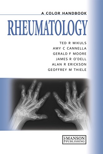 Rheumatology: A Color Handbook (Medical Color Handbook Series) - medicalbooks.filipinodoctors.org