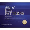 Atlas of EEG Patterns: 9781451109634: Medicine & Health Science Books ...