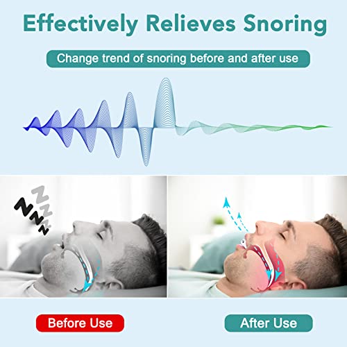 Anti Snoring Mouthpiece,Anti Snoring Devices,Anti Snoring Mouth Guard