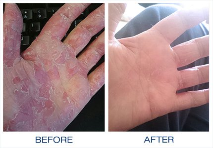 Gloves in a Bottle Shielding Lotion Great for Dry Itchy Skin, Grease-Less and Fragrance Free, 2 oz./60 mL, Pack of 3