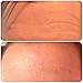 The Kami Pad Anti-Wrinkle Forehead Pad - Beauty Mask for Lifting & Hydrating Dry Skin. Antiwrinkle & Antiaging Repair & Prevention for Head Area. Safe Botox Alternative (1 Pack)