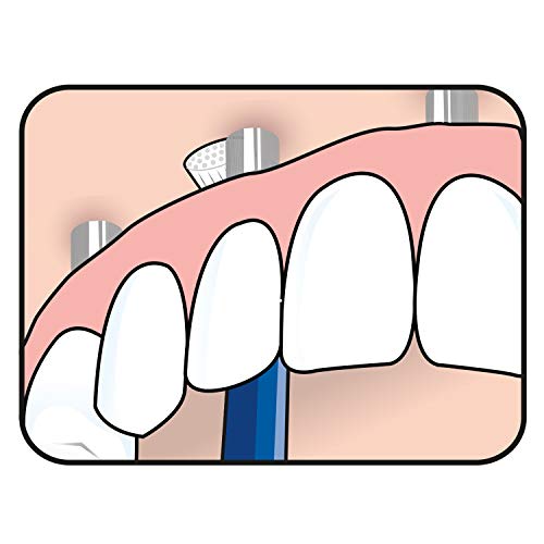 TEPE Universal Care Soft Slim Toothbrush - Angled for Braces, Retainers, Implants, 1 Pk