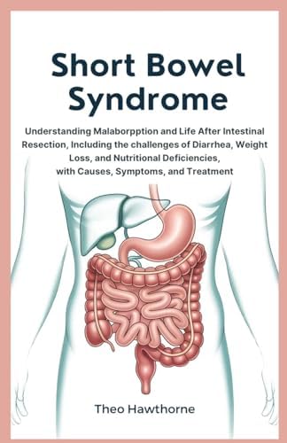 Short Bowel Syndrome: Practical Approach to Management: DiBaise