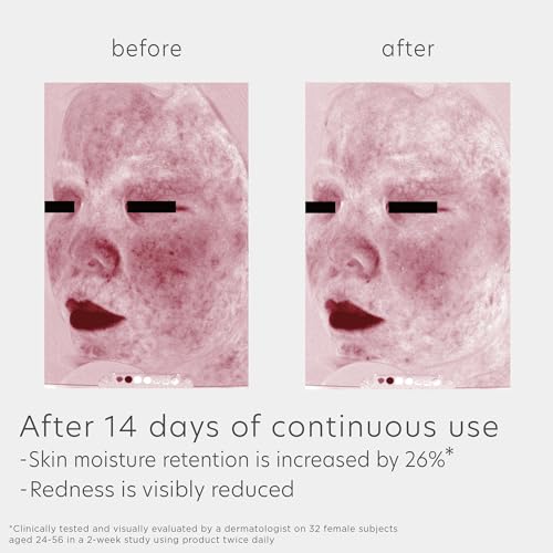 ELTAMD SKIN RECOVERY AMINO ACID FOAMING FACIAL CLEANSER, GENTLE FACE CLEANSER FOR SENSITIVE SKIN, 5.0 FL OZ