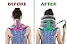 Hodilu Cervical Neck Traction Device - Pain Relieving Remedy Chronic Neck & Shoulder Alignment Pain - Inflatable & Adjustable Neck Stretcher Collar+ Pump Bonus