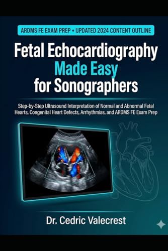 Fetal Echocardiography: A Practical Guide: 9780521695206: Medicine