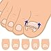 Gracefulvara Ingrown Toe Nail Correction Pedicure Wire Fixer Paronychia Recover Tool