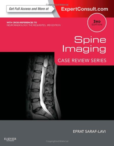 Download Spine Imaging: Case Review Series: Expert Consult - Online and Print, 3e Download Spine Imaging: Case Review Series: Expert Consult - Online and Print, 3e