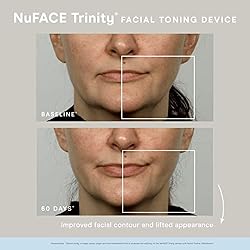 NuFACE Trinity and Effective Lip & Eye Attachment