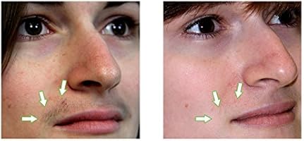 Facial Hair Growth Inhibitor Cream Minimizes Growth Of Unwanted