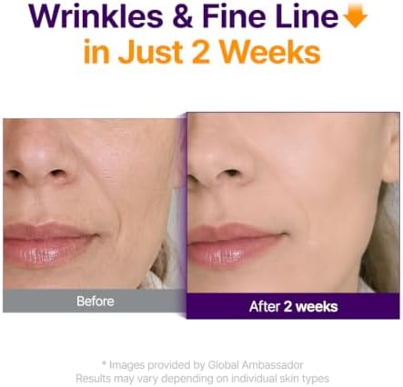 Retinol + Retinal Serum | Leichte Anti-Aging-Pflege