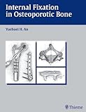 Internal Fixation in Osteoporotic Bone, , 3131284714