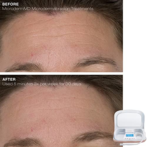 Trophy Skin MicrodermMD At Home Microdermabrasion Kit Anti Aging