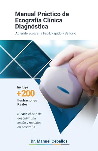 MANUAL PRÁCTICO DE ECOGRAFÍA CLÍNICA DIAGNÓSTICA: APRENDE ECOGRAFÍA FÁCIL, RÁPIDO Y SENCILLO (Spanish Edition)