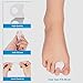 Gel Toe Separator & Stretcher Bunion Corrector Splint Kit, Relieve Pain of Hallux Valgus, Tailors Bunion and Hammer Toe, Rubber Silicon Toe Straightener Spacer Spreader Aid for Men and Women (A)