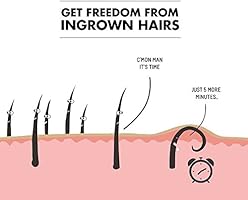 Tend Skin Liquid 4 Oz For Ingrown Hairs Razor Bumps For Use