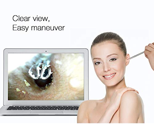 Supereyes USB Digital Otoscope Ear Pick | Stainless Curette Earwax Removal Kit | Ear Scope Ear Inspection Camera with LED Lights for Mac Windows