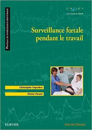 Résultat de recherche d'images pour "Surveillance fÅtale pendant le travail amazon"