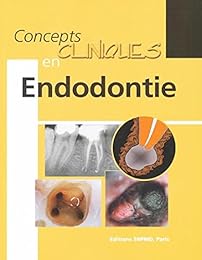 Concepts cliniques en endodontie