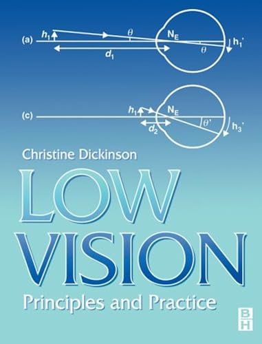 Download Low Vision: Principles and Practice PDF