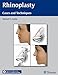 Rhinoplasty: Cases and Techniques