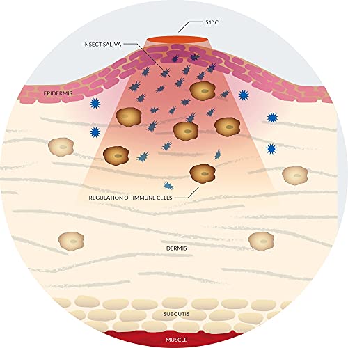 bite away® 3 Pack Insect Sting and Bite Relief, ChemicalFree Treatment, FDACleared and