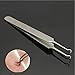 LuckyFine One Blackhead Comedone Acne Blemish Remover Nipper Stainless Beauty Tools