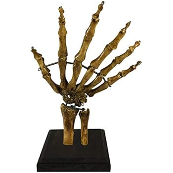 Asylum Zone Bizarre! Vintage 6 Finger Skeleton Hand Oddity Medical Specimen