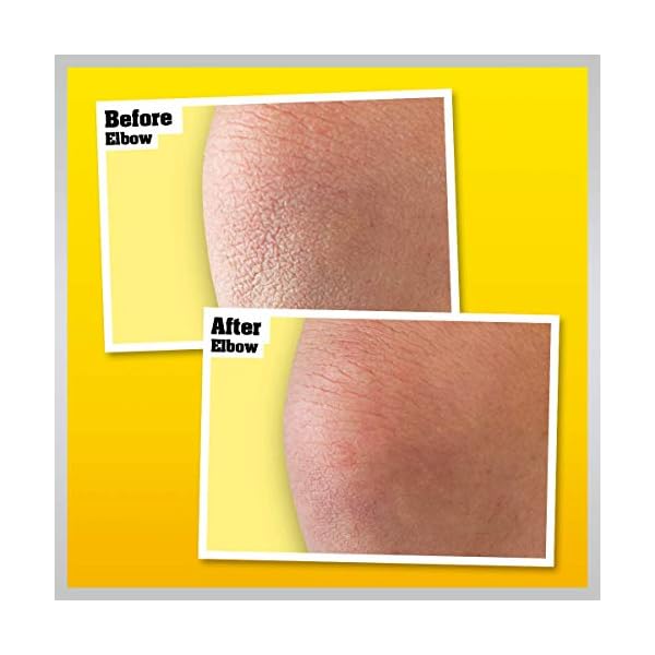 OKeeffes-Skin-Repair-Pump O'Keeffe's Skin Relief & Repair Pump, 325ml – Body Lotion for Extremely Dry, Itchy Skin | Unscented, Non-Greasy…