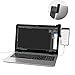 xcivi Screen and Mobile Connecting Holder- Mount Your Mobile to Your Laptop Screen- Dual Second Display for Your Notebook Computer (Black)