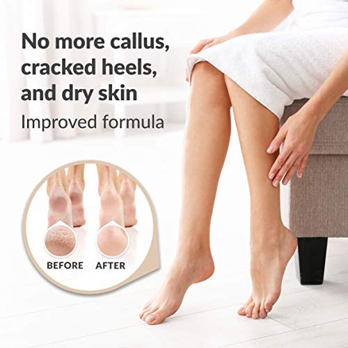 Foot-Peeling-Mask-Foot-Mask-Baby-Feet-Foot-Peel-Mask-Baby-Foot-Peel-Socks-Exfoliating-Foot-Peeling-Socks-pedicure-hard-skin-Remover-Callus-Exfoliator-Foot-Care-Kit-for-cracked-heels-2-Pairs