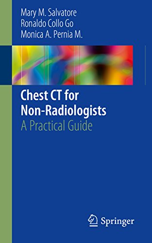 Ebook Chest CT for Non-Radiologists: A Practical Guide P.P.T
