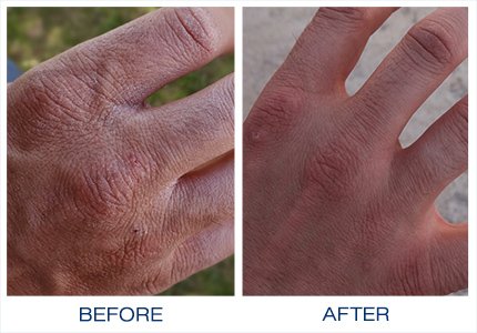 Gloves in a Bottle Shielding Lotion Great for Dry Itchy Skin, Grease-Less and Fragrance Free, 2 oz./60 mL, Pack of 3